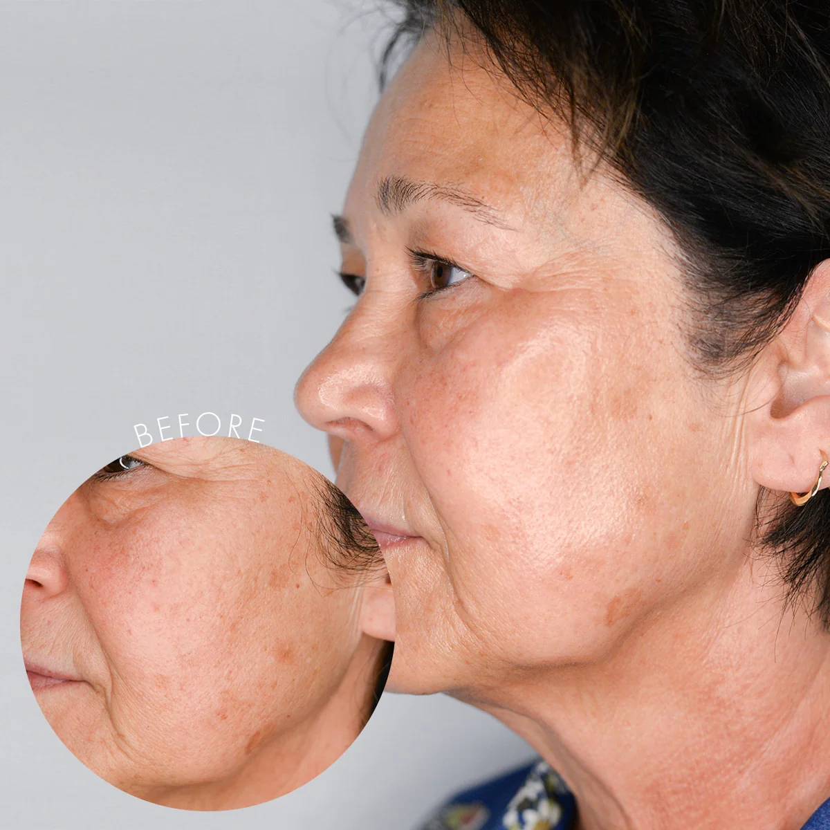 Healthy Aging Peel - Image 2