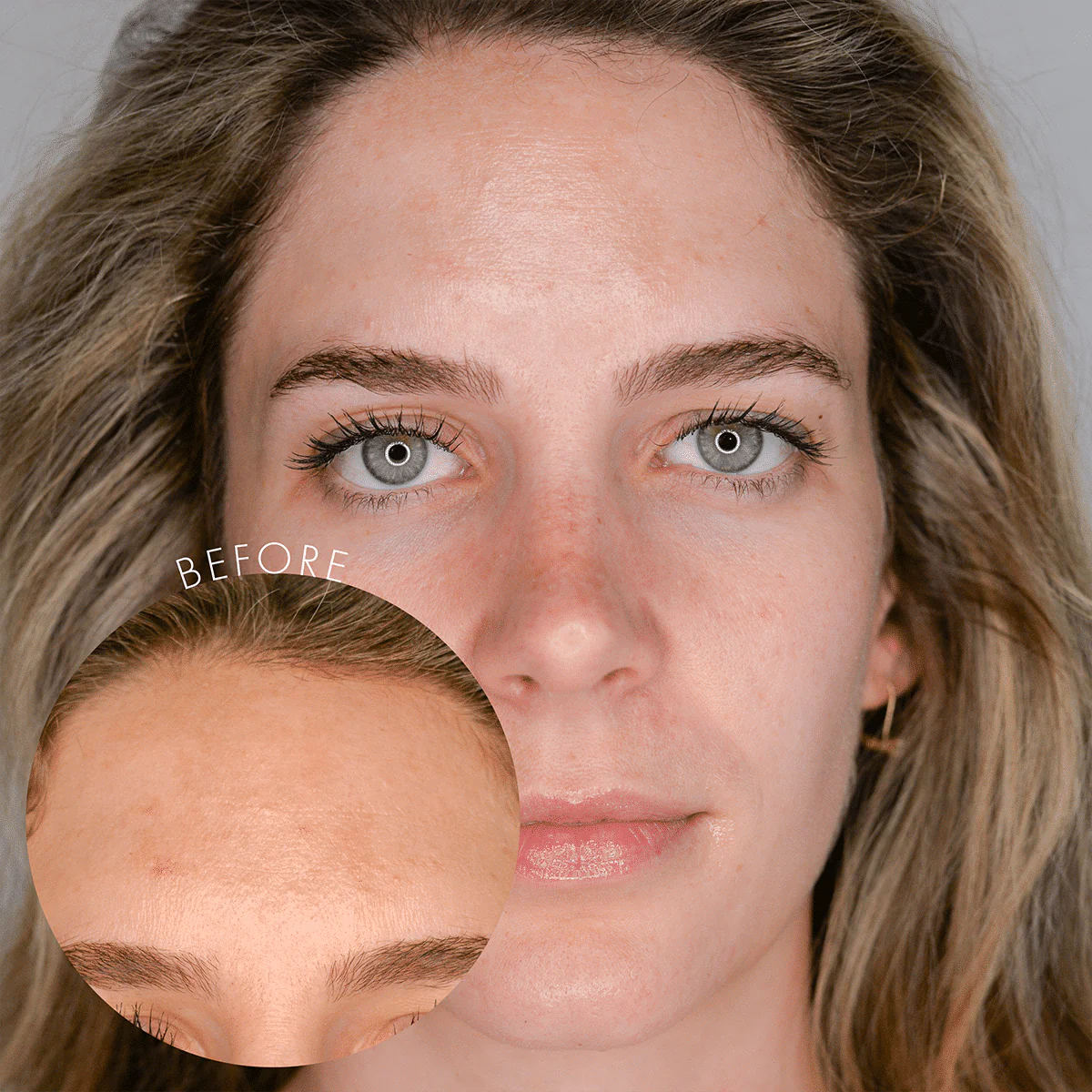 Maintenance Peel - Image 2